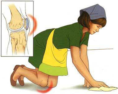 House Maid s Knee Capital Physiotherapy