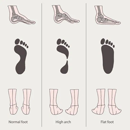 flat feet stances chart